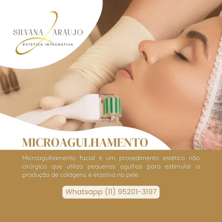 Microagulhamento Microagulhamento